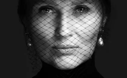 Anti Wrinkle Treatment kent