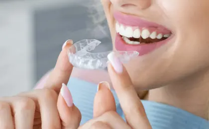 Invisalign Wimbledon