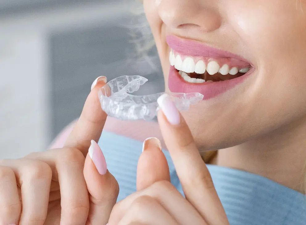 Invisalign Wimbledon