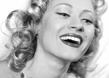 What Are Composite Fillings?