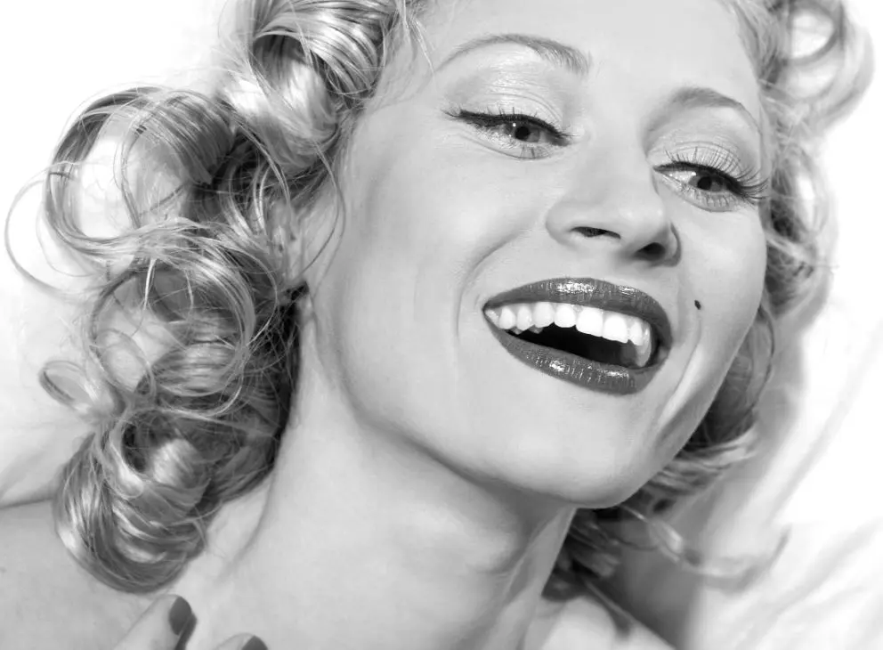 What Are Composite Fillings?