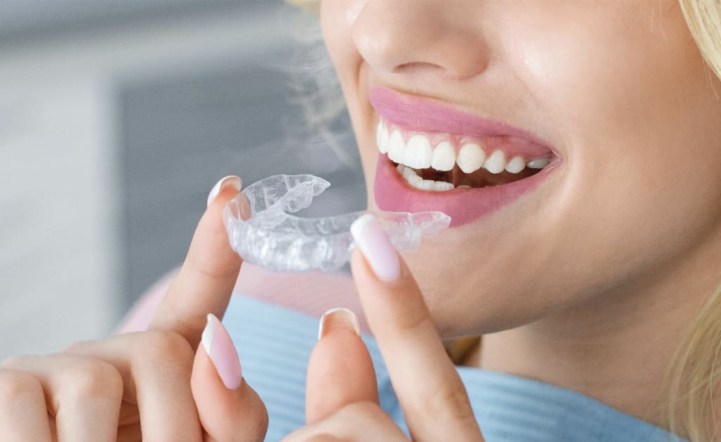 Invisalign Sevenoaks