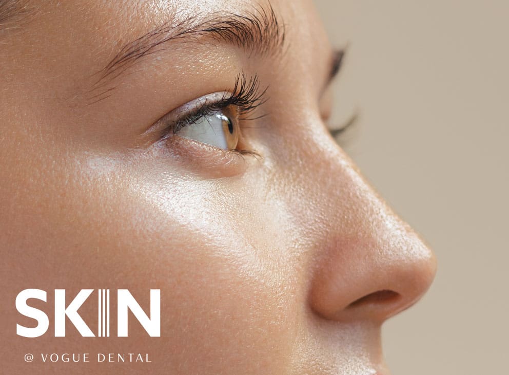 Skin@VogueDental - Non-surgical Rhinoplasty Treatment